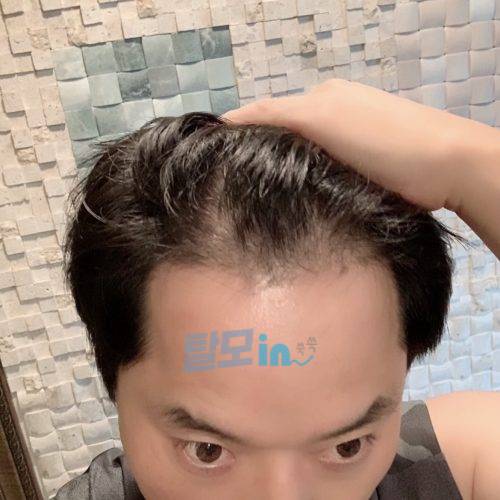 핀주브 800정 photo review