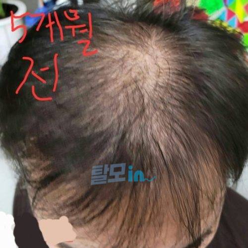 핀페시아 600정 photo review