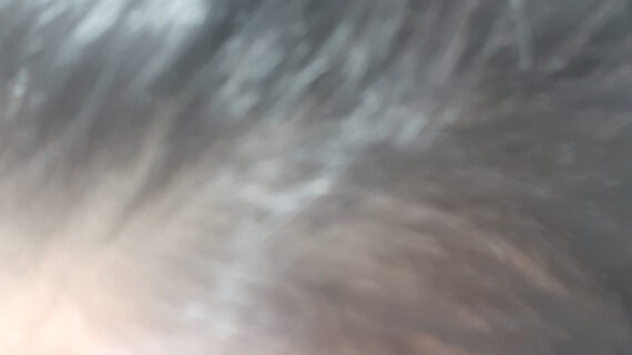 커클랜드 미녹시딜 6개월 photo review